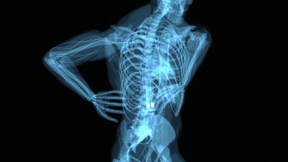 Atención en Traumatismo Raquimedular en Ciudad de México